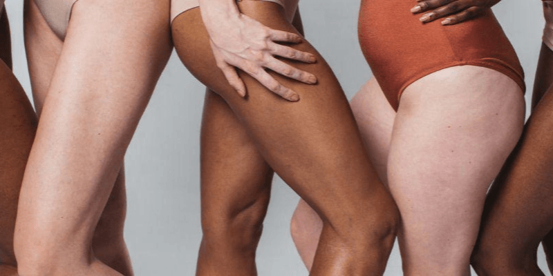 Cellulite | Chelsea Clinic