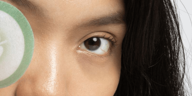 Dark eye bag | Chelsea Clinic
