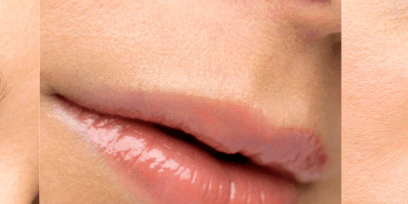 Facial features | Chelsea Clinic