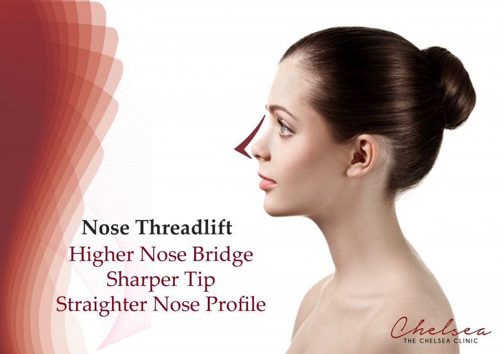 Nose Threadlift | Chelsea Clinic